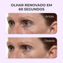 Lyftara - Gel Tensor Instantâneo Que Achata as Bolsas e Apaga as Olheiras em 60 Segundos (Oferta Exclusiva)